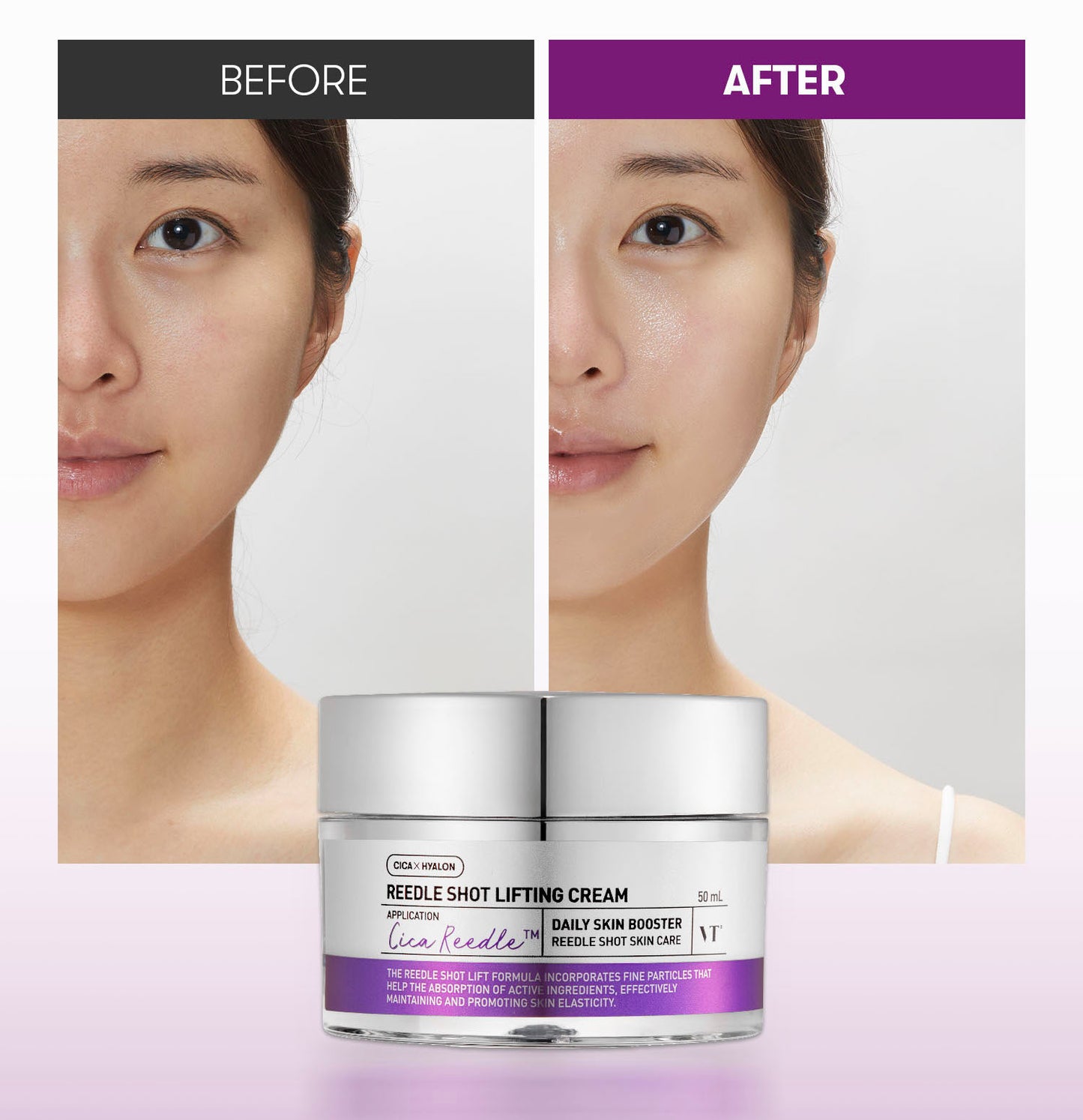 VT COSMETICS Reedle Shot Lifting Cream