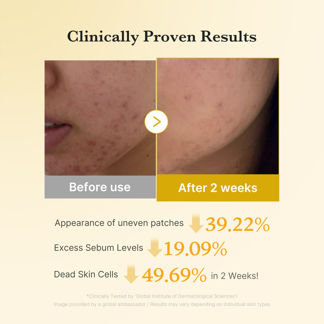 Medicube Kojic Acid Tumeric Toner Pad