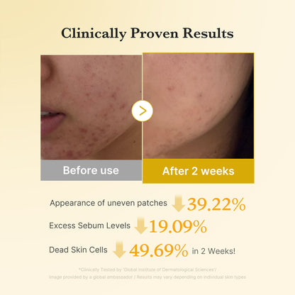 Medicube Kojic Acid Tumeric Toner Pad