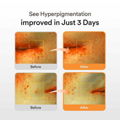 Abib Glutathiosome Dark Spot Serum Vita Drop