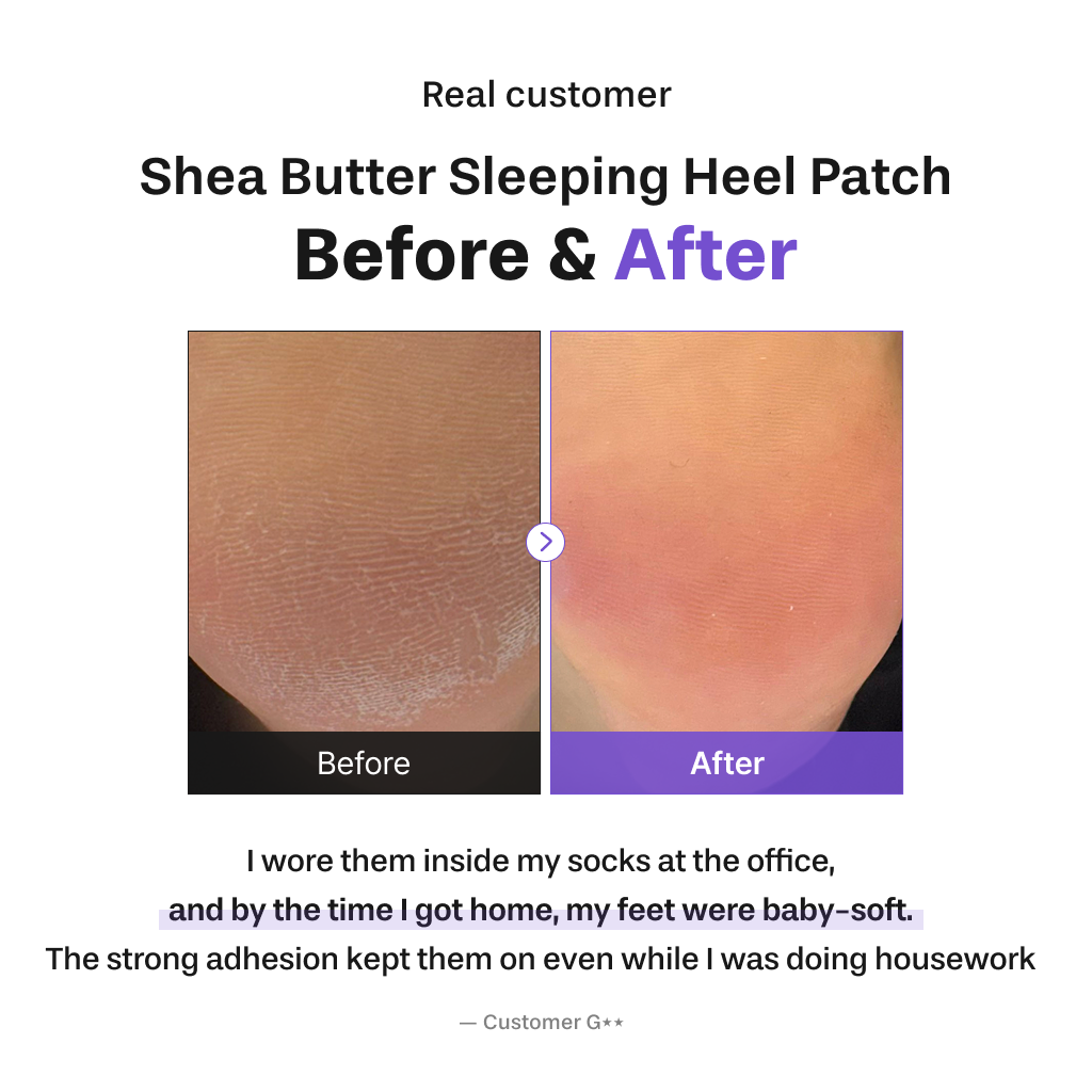 BAREN Shea Butter Sleeping Heel Patch (10ea)