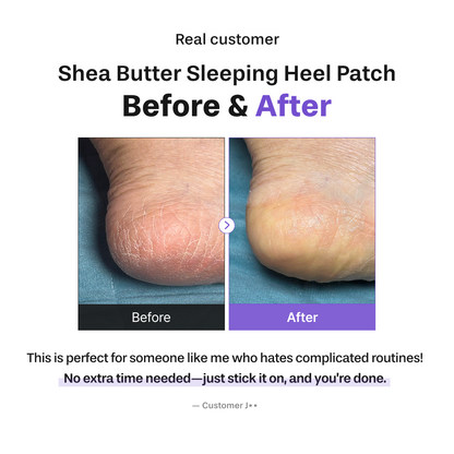 BAREN Shea Butter Sleeping Heel Patch (10ea)