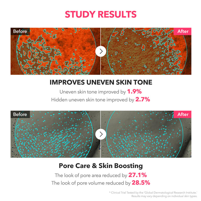 APRILSKIN TXA Niacinamide Toning Shot 99 Serum