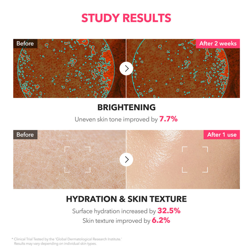 APRILSKIN TXA+Niacinamide 99 Pink Milky Toner