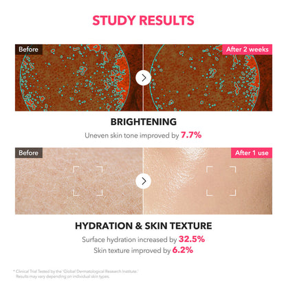 APRILSKIN TXA+Niacinamide 99 Pink Milky Toner