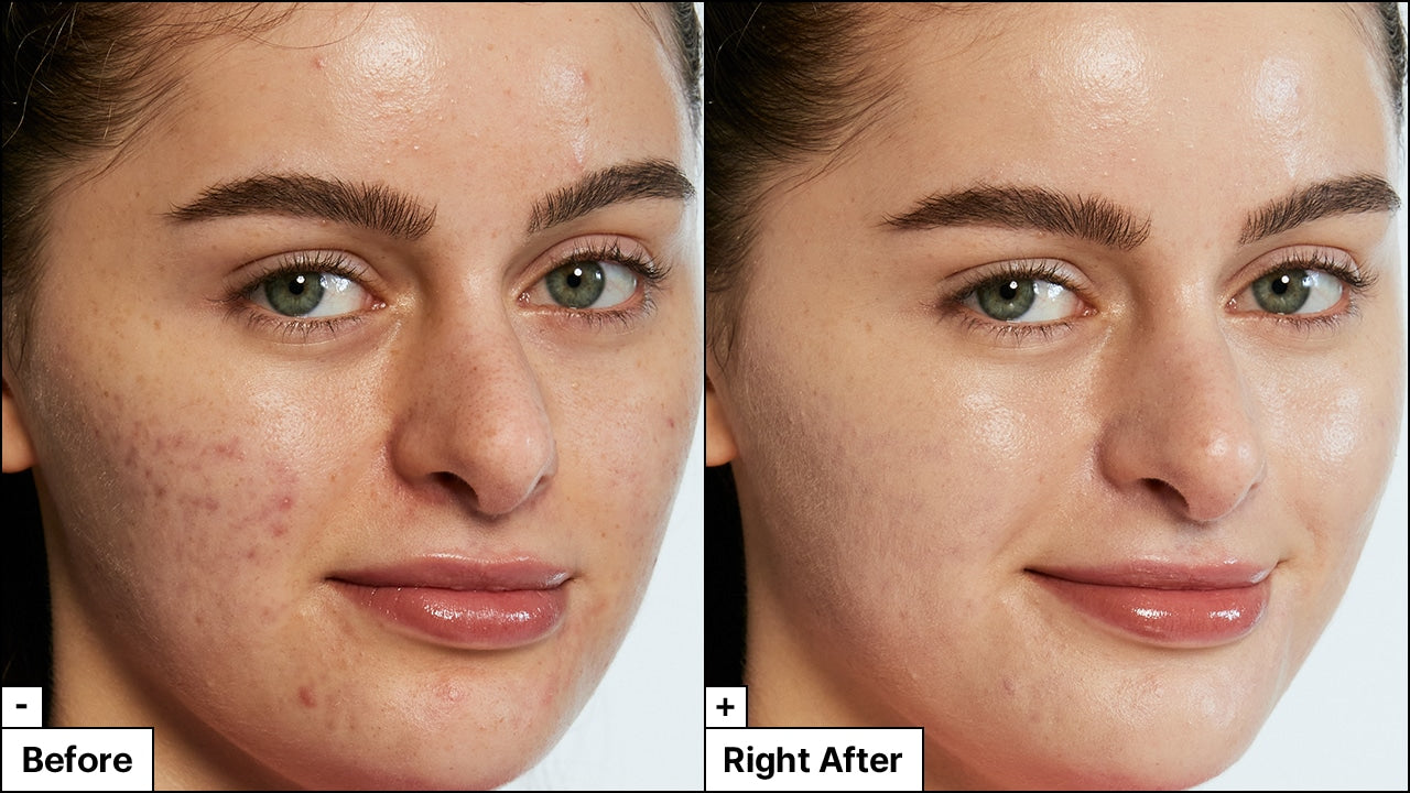Dr.Jart+ Tiger Grass Color Correcting Treatment