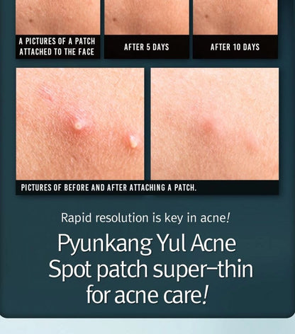 Pyunkang Yul Acne Spot Patch Super Thin