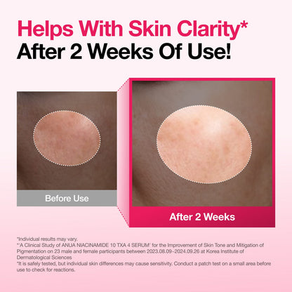 ANUA Niacinamide 10% + TXA 4% Serum