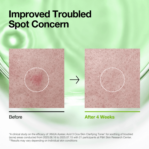 ANUA Azelaic Acid 3 CICA Clarifying Toner