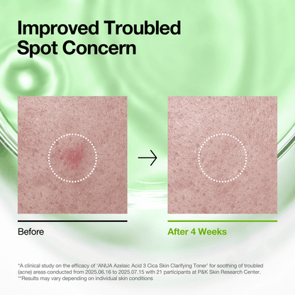 ANUA Azelaic Acid 3 CICA Clarifying Toner