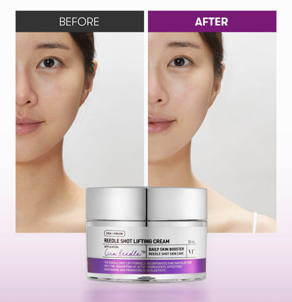 VT COSMETICS Reedle Shot Lifting Cream